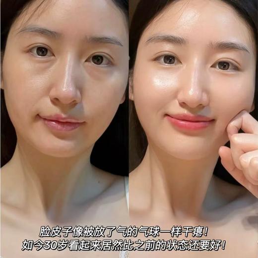 译龄精华液20+/25+/30+紧致早晚双抗a醇修护VC烟酰胺护肤修护抗皱补水去黄提亮分龄精华 商品图4