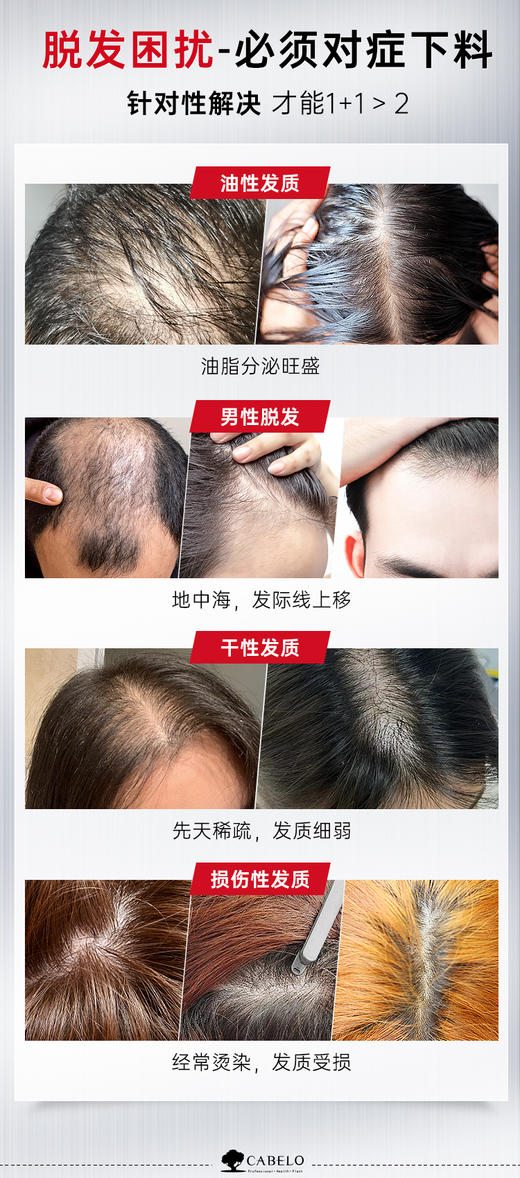 胖东来/屈臣氏同款防脱卡蓓诺加强型育发洗发水 商品图5