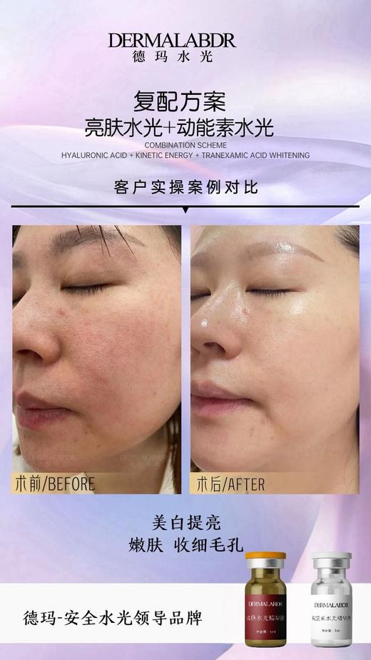 德玛-械字号水光精华液 商品图6