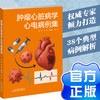 肿瘤心脏病学心电病例集 商品缩略图0