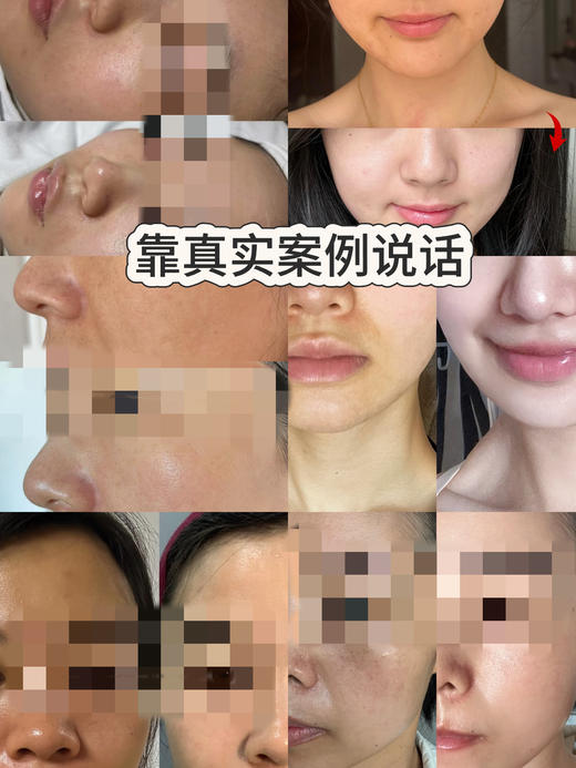 英锘-小灯泡发光调肤套，美白淡斑 祛斑 商品图6