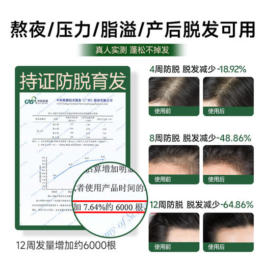 荷馨木质气囊按摩梳 商品图2