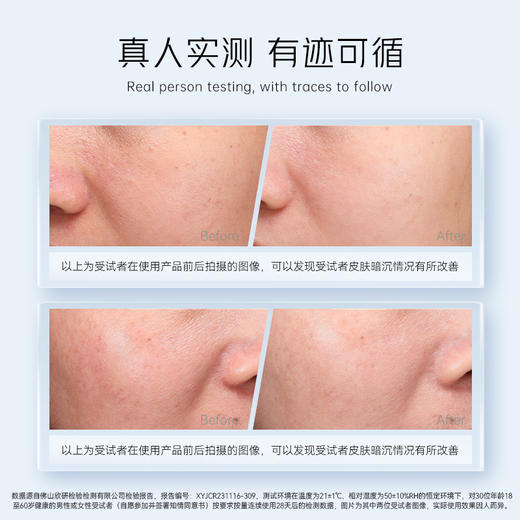 云滋泉抑黑焕白377囤货装  120支社群专属纯享组合（5支/袋）+赠品
 商品图1