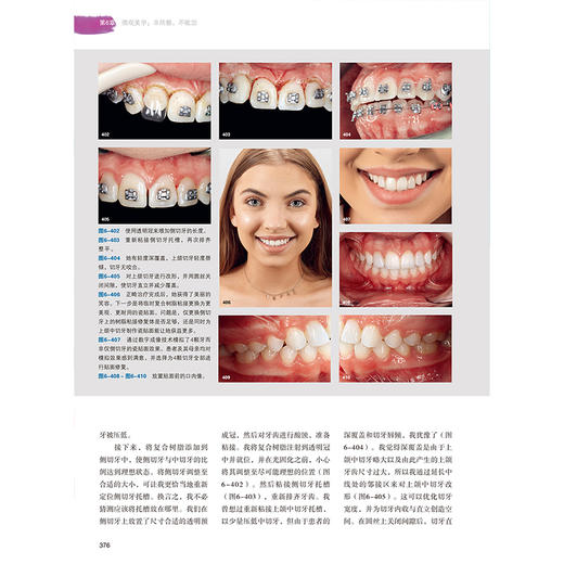 【出版社直发】口颌面美学 从宏观到微观 王璟 彭怡然 李晅 深度整合正畸修复牙周正颌外科乃至整形外科技术 辽宁科学技术出版社 商品图4