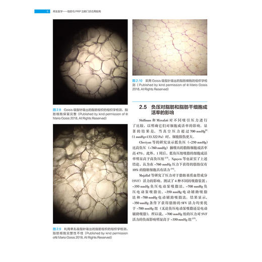 再生医学 脂肪与PRP注射门诊应用指南 黄昕昕 刘晓燕 适合于从事再生治疗的皮肤科整形科烧伤科医生阅读的参考书辽宁科学技术出版社 商品图3