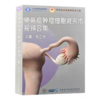 卵巢癌肿瘤细胞减灭术视频合集 U盘版 商品缩略图0