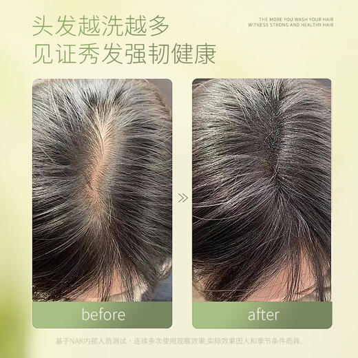 nak防断发强韧生姜洗发乳液645g 商品图4