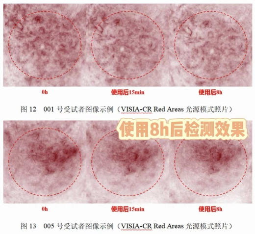 【到手30支45ml】华熙生物｜米蓓尔舒缓安肤次抛精华正装 商品图4