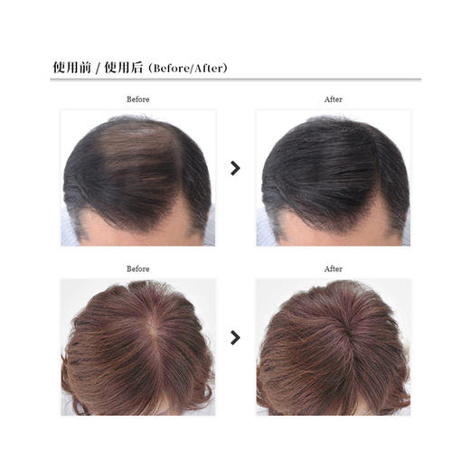 SUPERMILLIONHAIR/迷丽发增发纤维假发喷雾遮秃补头发密 商品图4