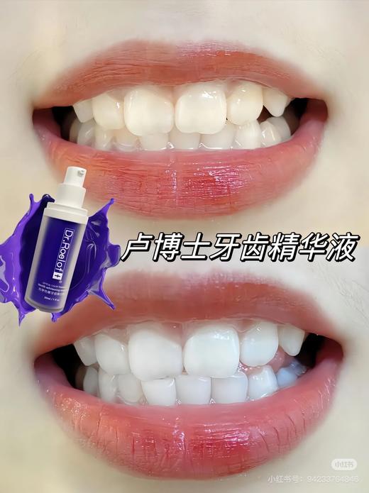 D&r光感美白去渍牙膏 商品图3