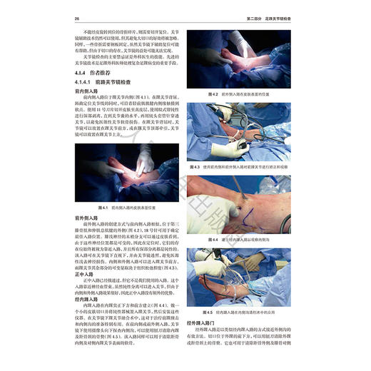 足踝关节镜与内镜：原理与实践 吕敦庆 主编 详尽的关节镜和内镜在足踝外科中的应用指南 采用图文并茂的形式 人民卫生出版社 商品图4