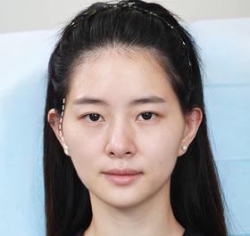 这是一条只有菱形脸才会刷到的视频...