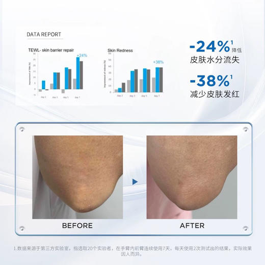 西班牙 sesderma赛斯黛玛 升级款烟酰胺保湿焕白/果酸换肤去鸡皮 身体乳 400ml/200ml 商品图4