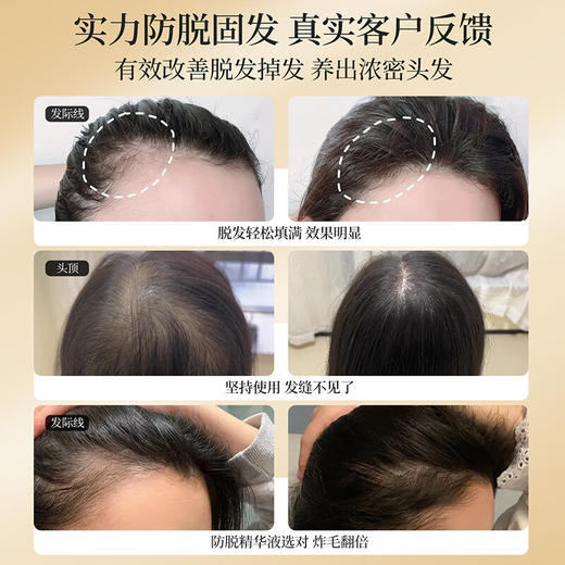 诗碧曼 防脱固发精华液100ml 养根固发改善头皮环境 商品图1