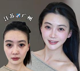 OMG~当30＋女性去微调，真的只是做了提升..