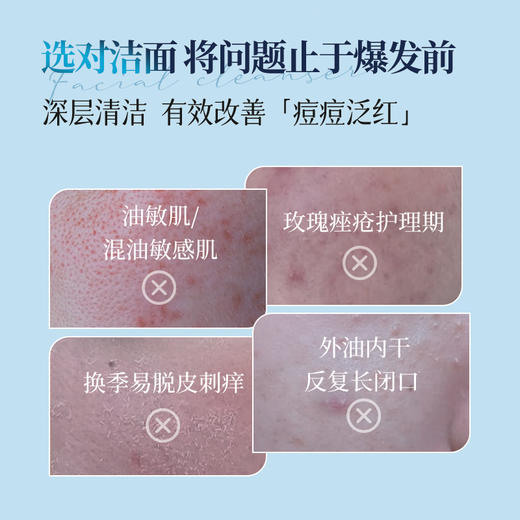 【超值3支装】DR.Alia pro 蛋白靓肤修护洁面乳 韩国本土在售 敏感肌可用 温和清洁 100g*3支 商品图1