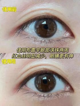  1个简单小动作，眼睛清亮一整天！不干不胀不糊，远离老花白内障