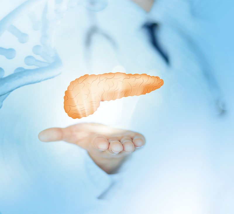 胰腺癌甲基化检测