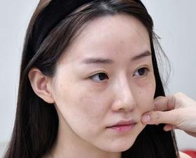 肉肉垮脸显老？三步带你颜值回春