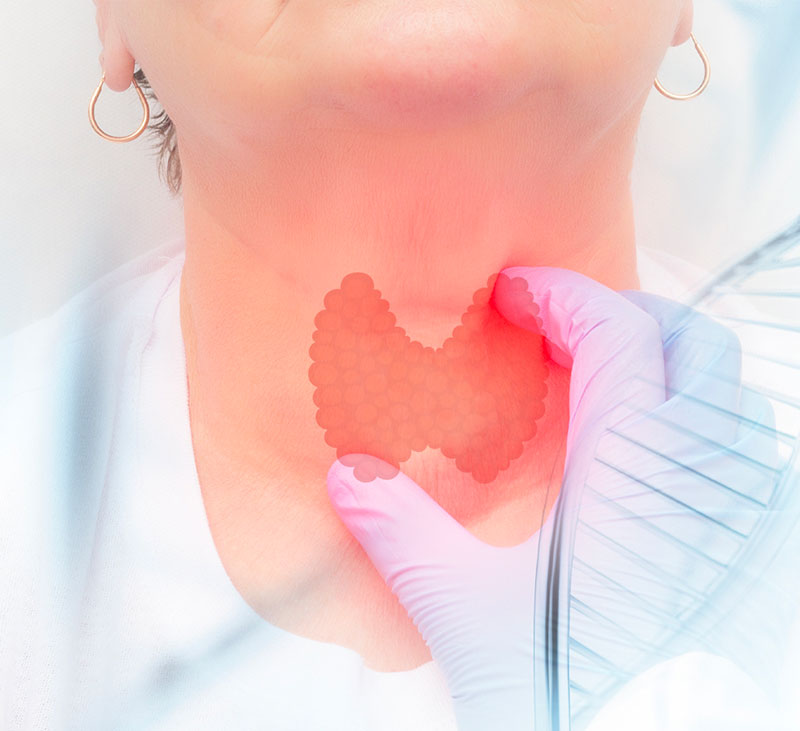 甲状腺癌甲基化检测