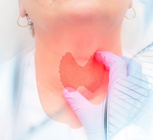 甲状腺癌甲基化检测 商品图0