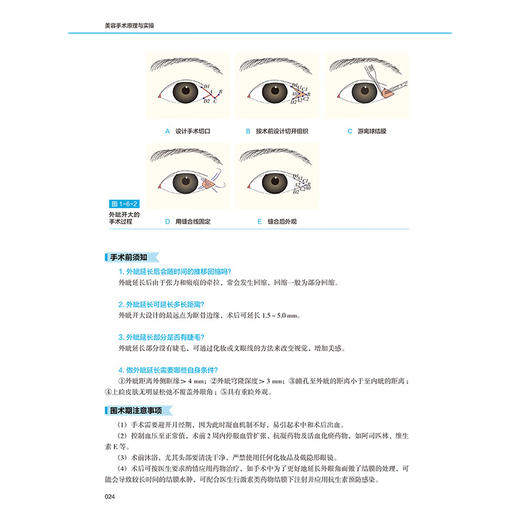 美容手术原理与实操 曹政 介绍了美容外科常见手术的围术期注意事项 初级医师 医师助理及求美者了解美容手术 辽宁科学技术出版社 商品图4