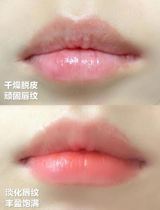 【多妈团购 法国依泉润唇膏】小白管/小蓝管，养出水嫩嘟嘟唇，修护级配方，唇纹、死皮、干裂通通消灭，蓝管晚上涂，白管白天涂，日滋夜养-金克丝 商品图8