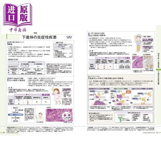 【中商原版】发现病症 vol.3 糖尿病・代谢・内分泌 日本医学专业留学必备书系列 日文原版日韩 病気がみえる vol.3 商品图4