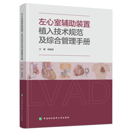 左心室辅助装置植入技术规范及综合管理手册 胡盛寿 主编 内容涵盖患者筛选与术前评估 手术操作技术要点等中国协和医科大学出版社 商品图1