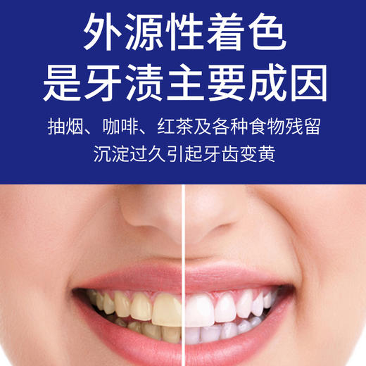 【牙膏界的“烟酰胺”】Biminne别敏无水美白牙膏 无水热感配方 含密集美白粒子 去渍修复亮白多效合一 100克/支 商品图6