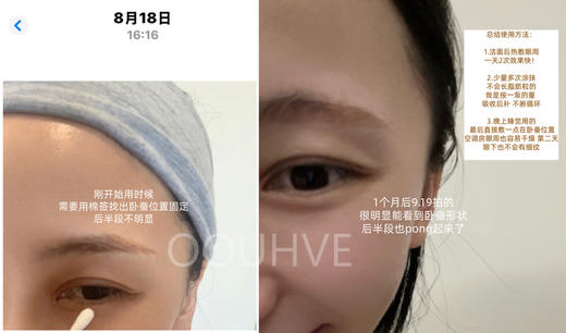 反馈在主图后/无痛填充脂/肪管理福气脸芳疗精油法国进口丰匈紧致乳提升聚拢产后下垂松弛熊部萎缩修复纯进口原料无激素（丰唇 臀/脸/卧蚕/眼窝/面凹 商品图1