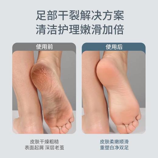 （美克斯）电动磨脚器 NV8615G 商品图2