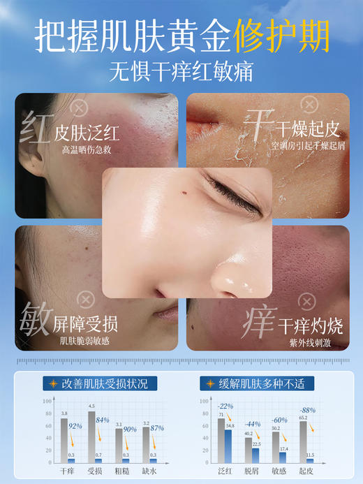 【速补水·高保湿·强修护】重组胶原蛋白高保湿面霜补水滋润肌肤舒缓晒后泛红屏障受损修护 商品图4
