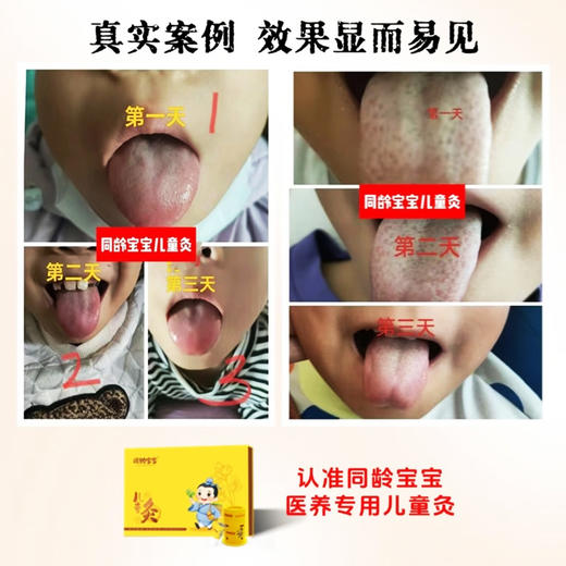 同龄宝宝儿童灸（6送1） 商品图2