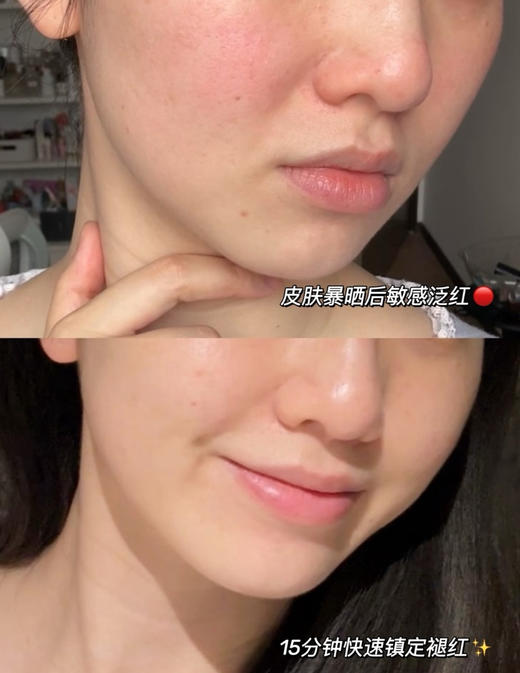 【到手两瓶】薇诺娜安肤喷雾50ml超值！ 商品图5