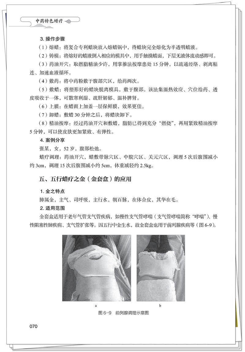 ISBN 978-7-5132-9464-5 中药特色蜡疗+邸迅+CTP_82_副本.jpg