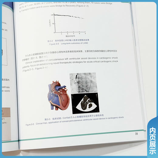 血管外科年度报告2024 国家心血管病中心中国医学科学院阜外医院 胡盛寿 主编 特色医疗 9787567927179 中国协和医科大学出版社 商品图3