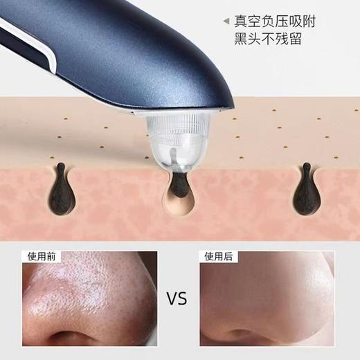 金稻吸黑头仪电动去黑头吸出毛孔清洁器美容仪器深层清洁收毛孔 商品图1