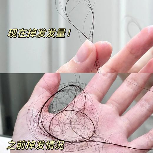 【89.9元，拍1发3】Novella那绯澜防脱洗护套装 | 针对脱发，这个老方子真的有效！但要这么用 商品图3