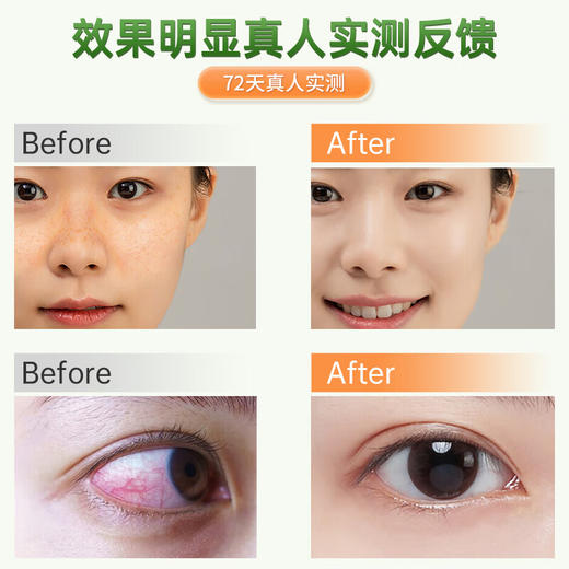 美国原装进口 优乐驰ULOTER 水飞蓟籽油蒲公英复合片60片/瓶 商品图6