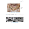 【出版社直发】循解剖之道 口腔种植临床解剖图谱 徐光宙 融合基础解剖数字影像与临床实践的口腔种植手术地图 辽宁科学技术出版社 商品缩略图4