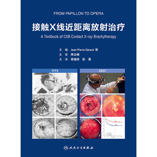 接触X线近距离放射治疗 商品图1