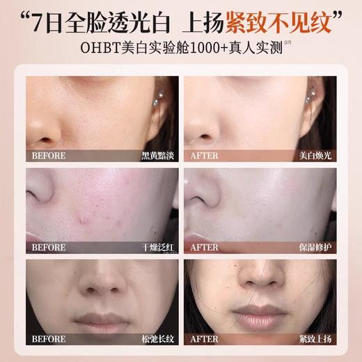OHBT虾青素传明酸嫩肤面霜50g 商品图1