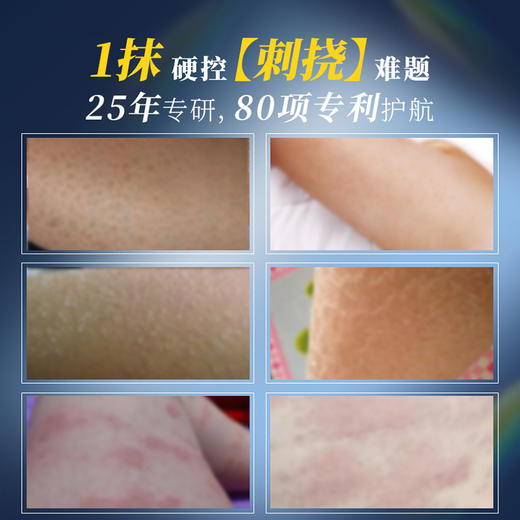 悠贝特舒润止痒乳液 商品图2