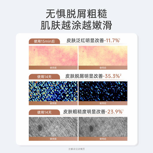 【身体乳系列】 高保湿 改善紧绷干痒 柔润全身 袋鼠妈妈小麦胚芽水润倍护身体乳180g 商品图8