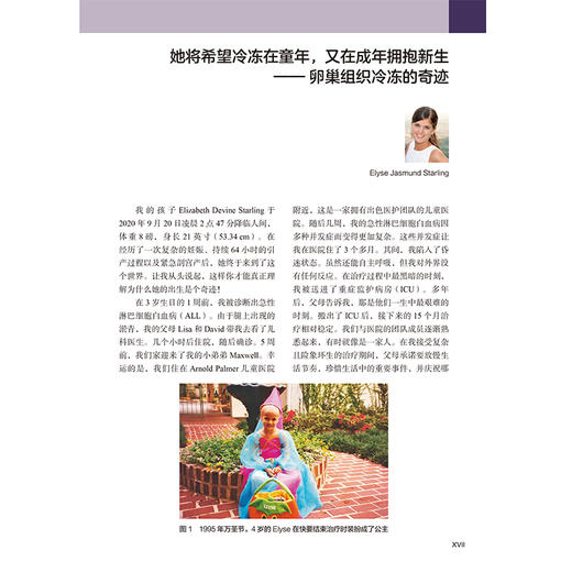 《卵巢组织冷冻保存与移植：原理与实践》 商品图5