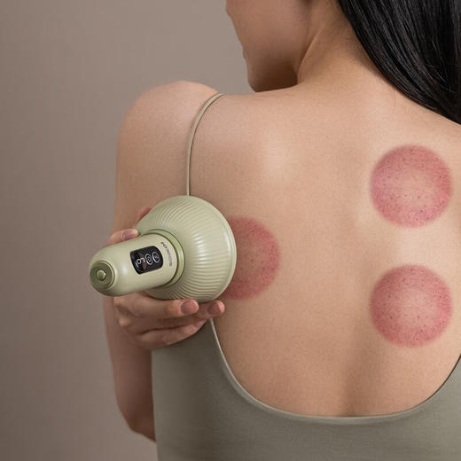 【分仓直发包邮】SOIKOI司崎库电动拔罐器礼盒S16 商品图2