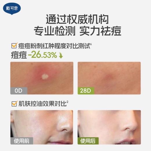 戴可思青少年洗面奶青春期控油祛痘学生男女孩洁面乳♥ 商品图3