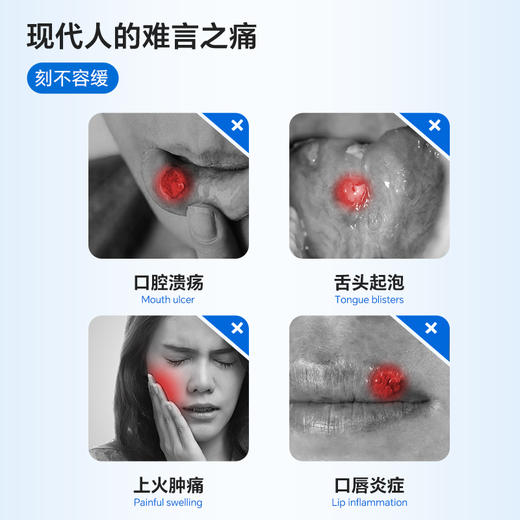 复因医用口腔溃疡含漱液 15mL*10袋 商品图1