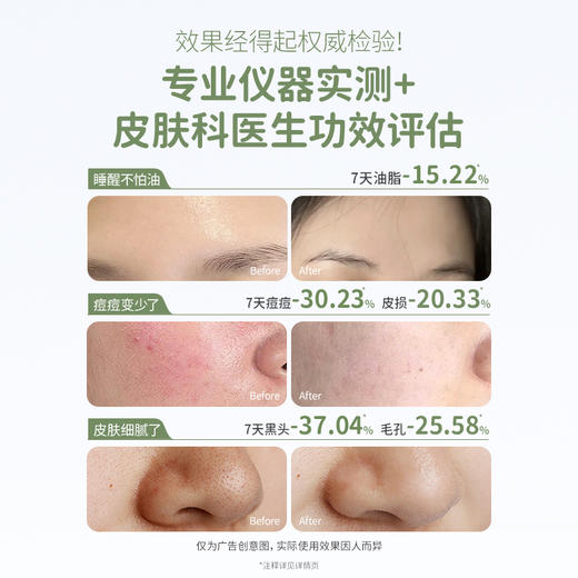 【青少年防痘3件套】补水控油防冒痘 袋鼠妈妈青少年安肌护肤3件套（洁面+水+乳）） 商品图3